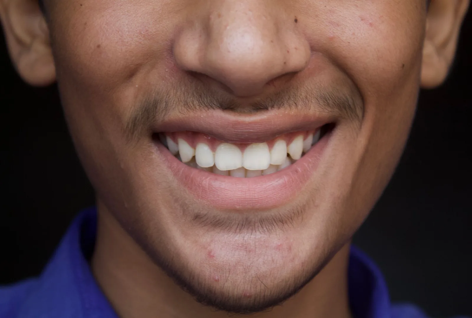 A confident smile after cosmetic treatment
